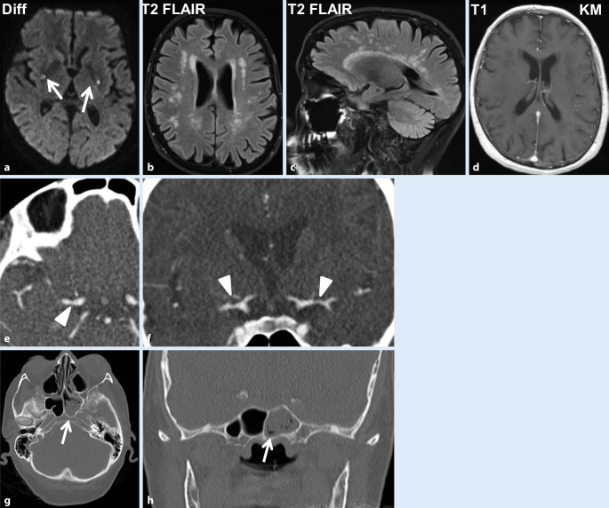 graphic file with name 115_2020_966_Fig1_HTML.jpg