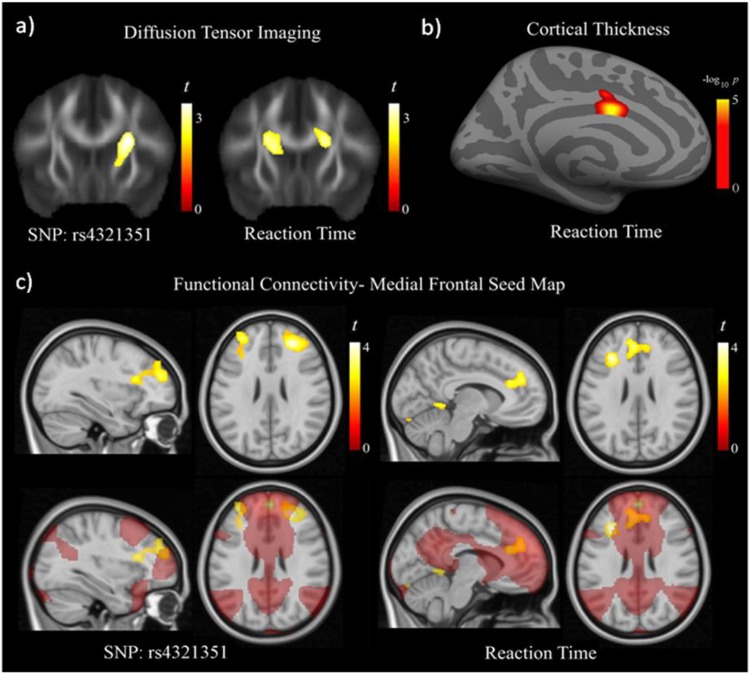 Fig 3