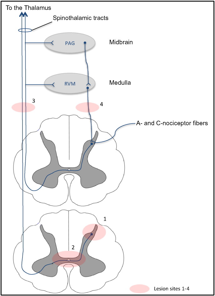 Fig. 2