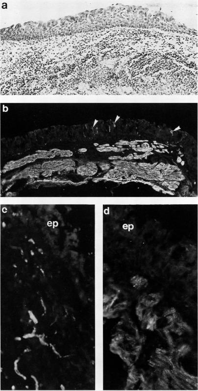 graphic file with name thorax00310-0087-a.jpg