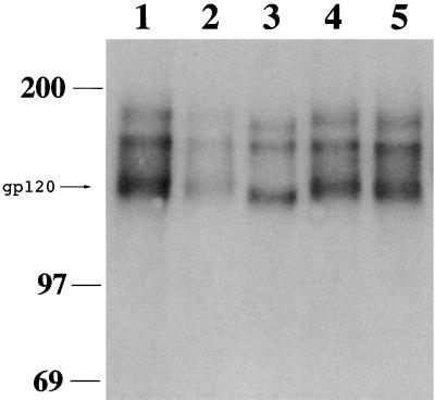 FIG. 11