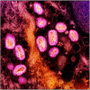IRF - Frederick 01/10/11 9:52:48 a 21000 7.0 80.0 Imaging #10-044-2 #10018 Lymph Node OSD 13E -881.32668 -38.949968 0.01 XpixCal=342.667 YpixCal=342.667 Unit=um ##fv3