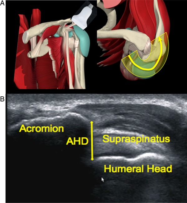 Figure 2 