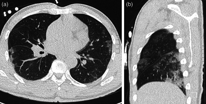 FIGURE 1