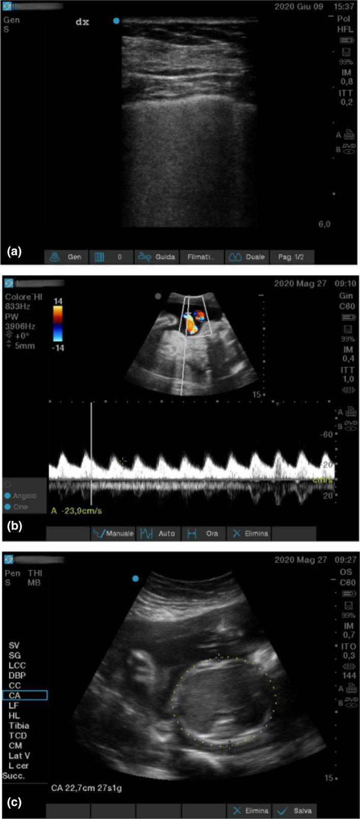 FIGURE 2