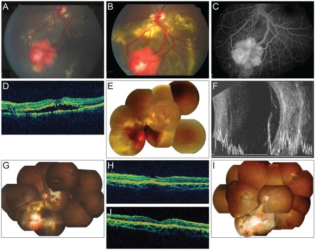 Fig. 1