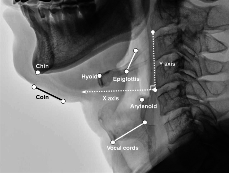 Fig. 3