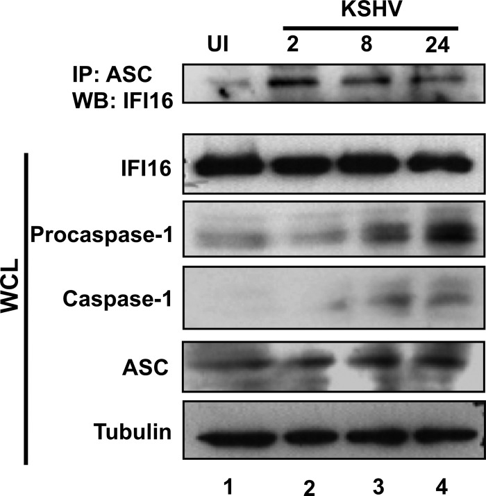 Fig 11