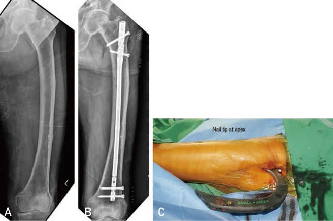 Fig. 10