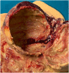 Fig. 12