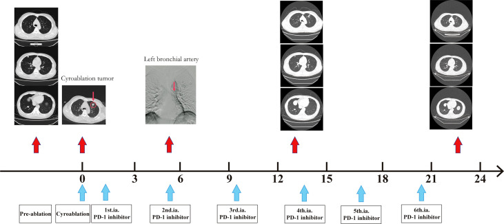 Figure 1