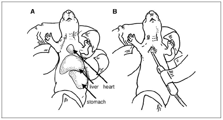 Figure 15.21.2