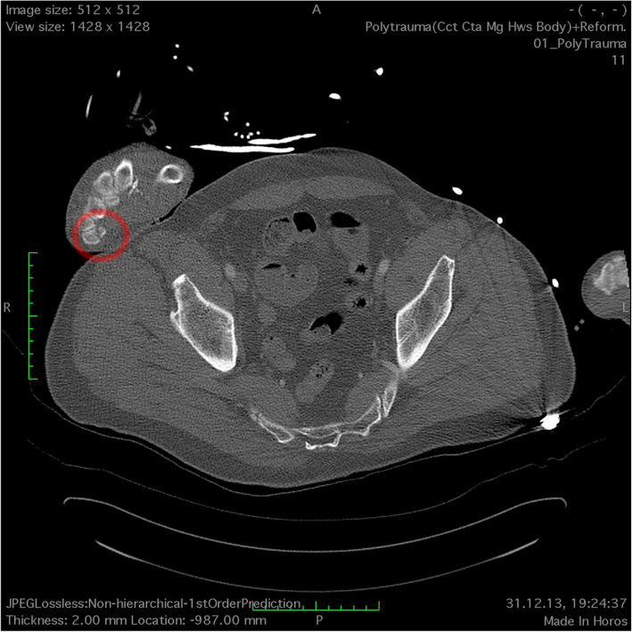 Fig. 1