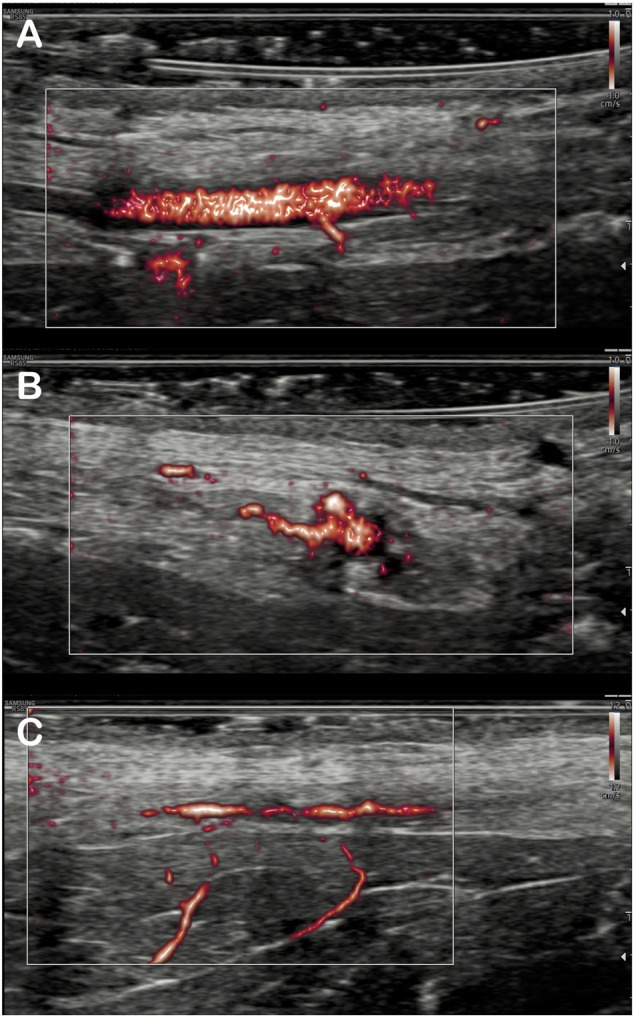 FIGURE 2