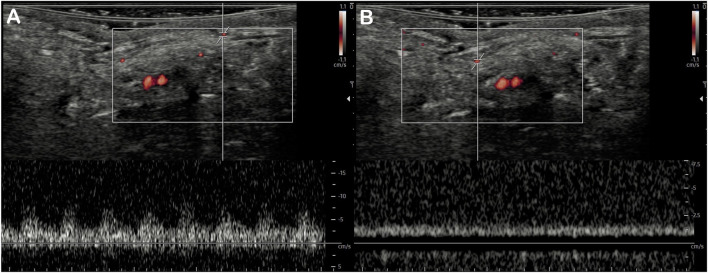 FIGURE 3