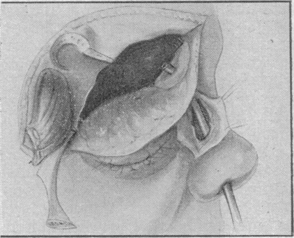 Fig. 10