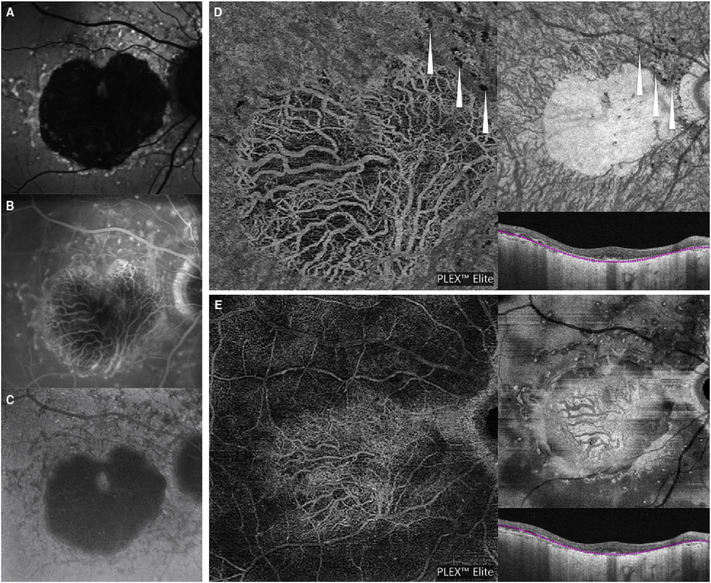 Fig. 73.