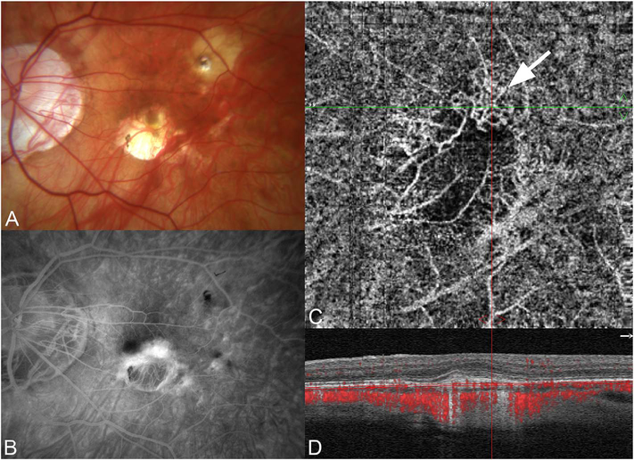 Fig. 69.