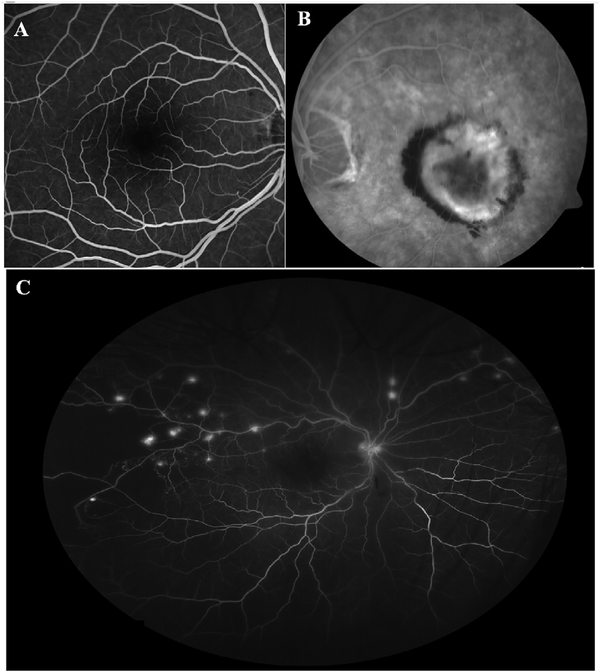 Fig. 26.