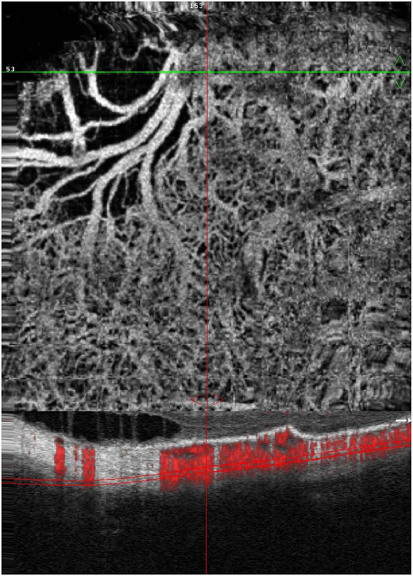 Fig. 23.