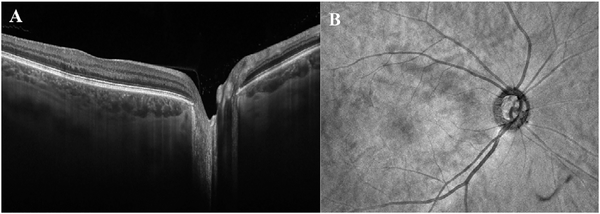 Fig. 27.