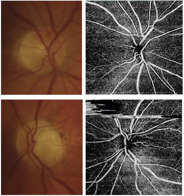 Fig. 79.