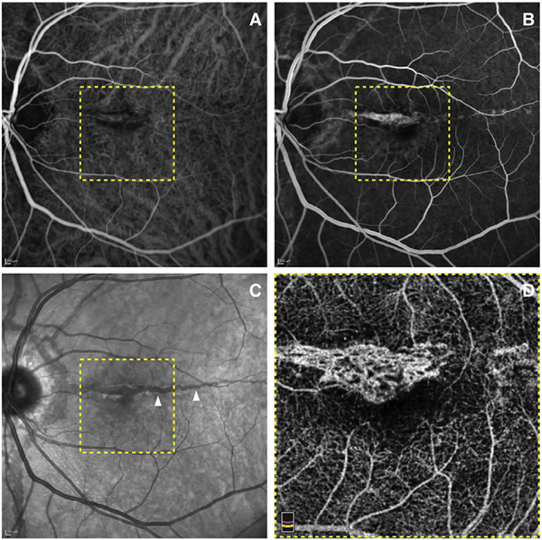 Fig. 62.