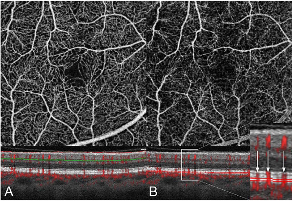 Fig. 21.