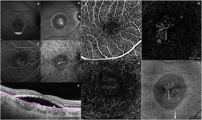 Fig. 72.