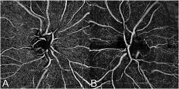 Fig. 76.