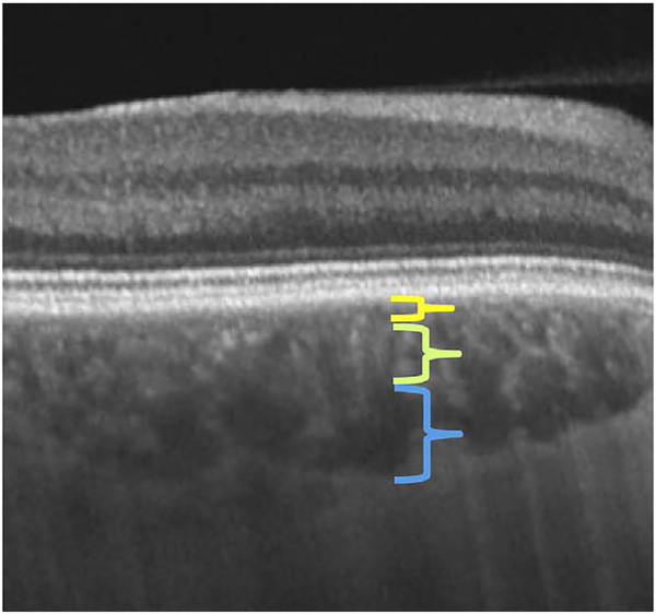 Fig. 28.