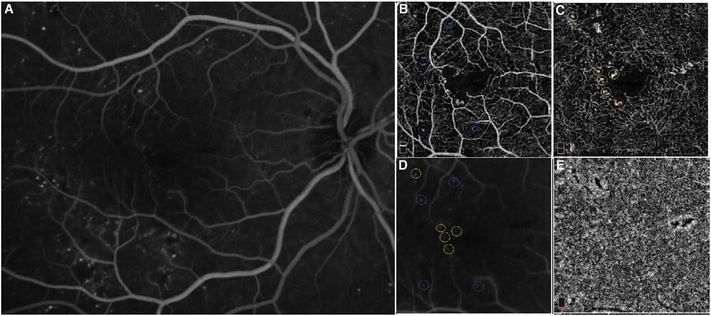 Fig. 38.