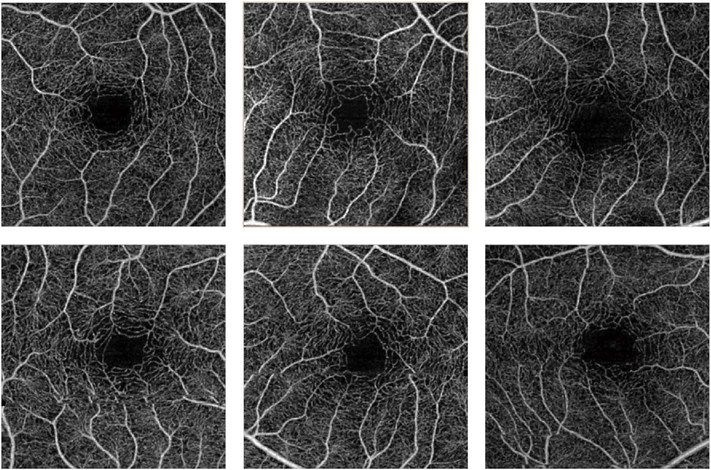 Fig. 31.