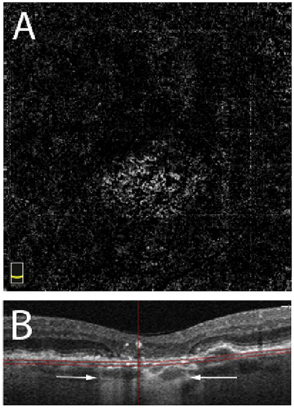 Fig. 59.