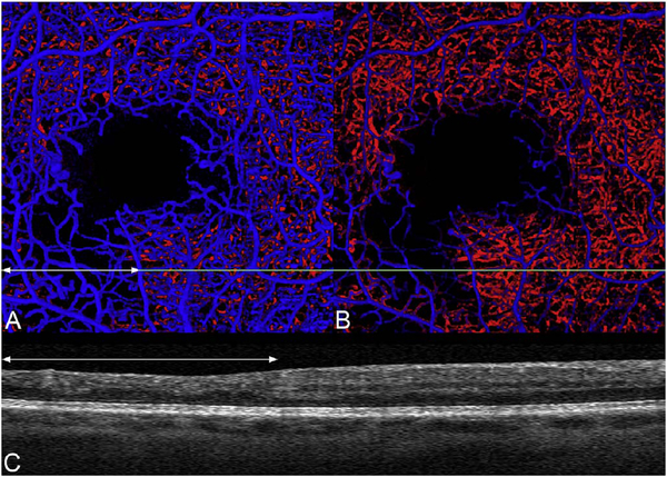 Fig. 41.