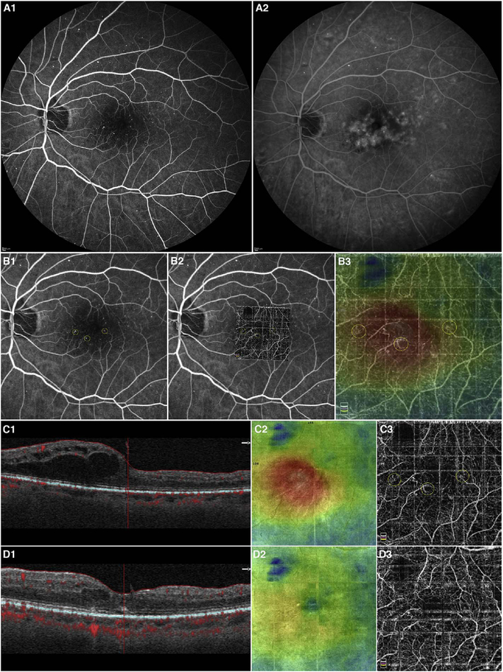 Fig. 42.