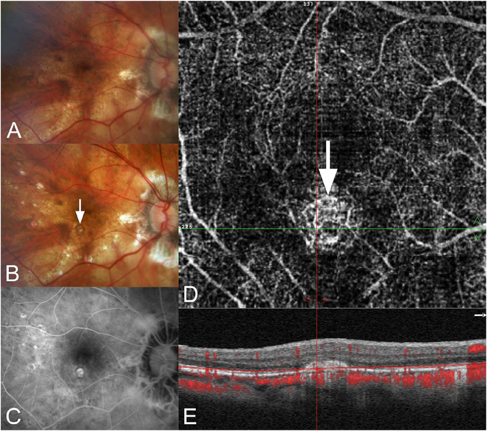 Fig. 71.