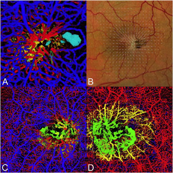 Fig. 12.