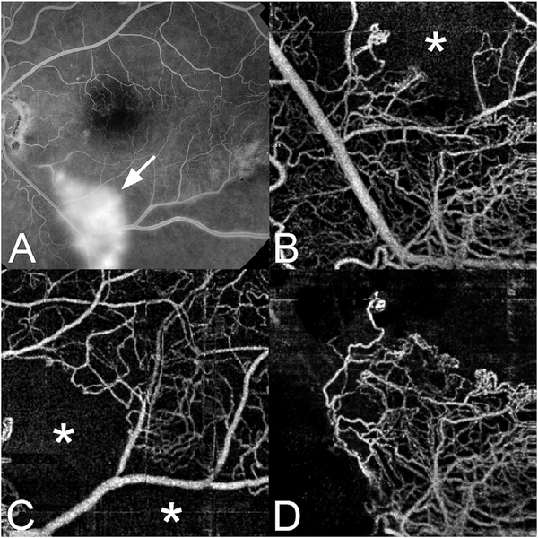 Fig. 63.