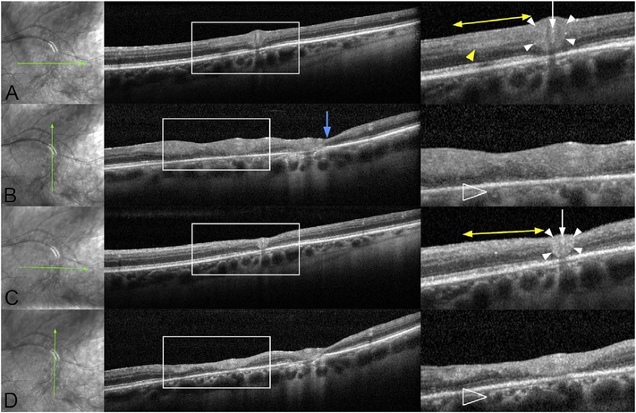 Fig. 65.