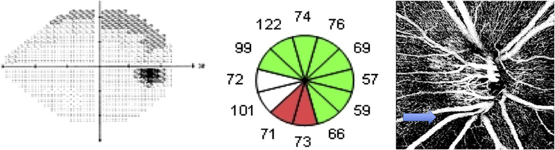 Fig. 75.