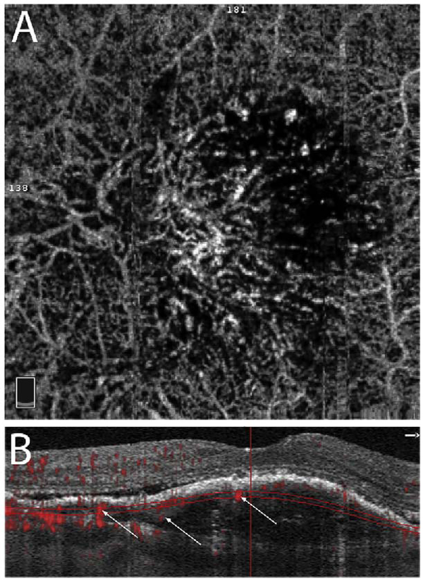 Fig. 56.