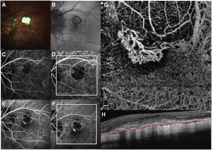 Fig. 61.