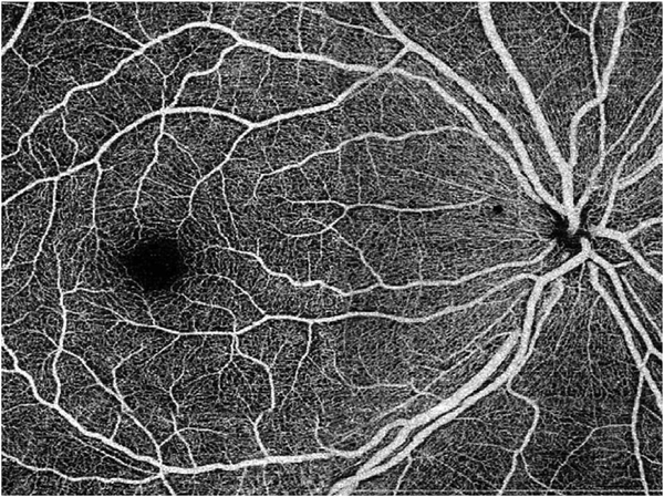 Fig. 29.