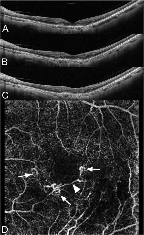 Fig. 70.