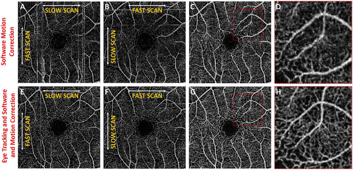 Fig. 16.