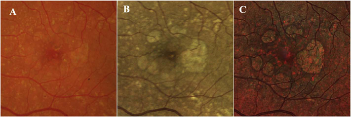 Fig. 24.