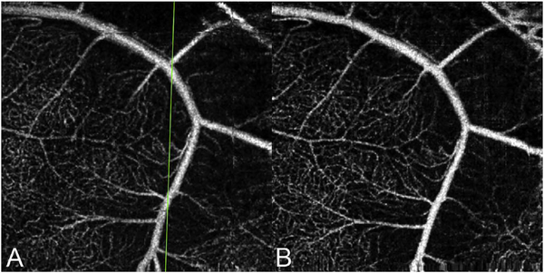 Fig. 66.