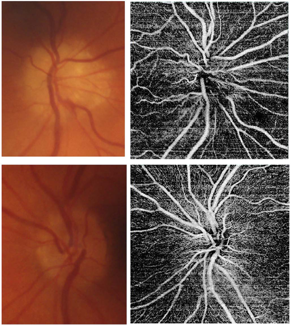 Fig. 78.