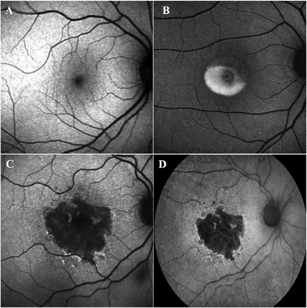 Fig. 25.